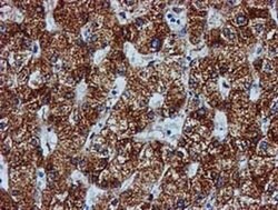 GATM Mouse anti-Human, Clone: OTI1E3, liquid, TrueMAB 100 &mu;L; Unconjugated:Antibodies,