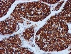 GATM Mouse anti-Human, Clone: OTI1E3, liquid, TrueMAB 100 &mu;L; Unconjugated:Antibodies,