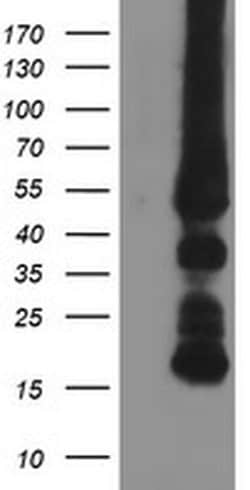 GATM Mouse anti-Human, Clone: OTI1E3, liquid, TrueMAB 100 &mu;L; Unconjugated:Antibodies,
