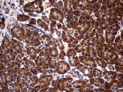GBA Mouse anti-Human, Clone: OTI4G4, lyophilized, TrueMAB 100 &mu;g; Unconjugated:Antibodies,