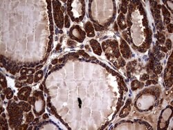 GBA Mouse anti-Human, Clone: OTI4G4, lyophilized, TrueMAB 100 &mu;g; Unconjugated:Antibodies,