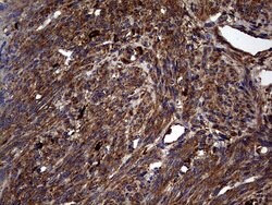 GBA Mouse anti-Human, Clone: OTI4G4, lyophilized, TrueMAB 100 &mu;g; Unconjugated:Antibodies,