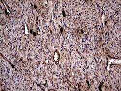 GBA Mouse anti-Human, Clone: OTI4G4, lyophilized, TrueMAB 100 &mu;g; Unconjugated:Antibodies,