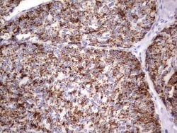 GBA Monoclonal Antibody (OTI2C12), TrueMAB , OriGene 100 &mu;L; Unconjugated:Antikörper