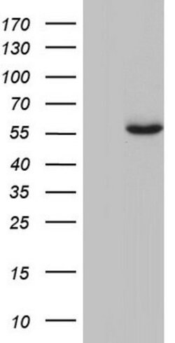GBA Mouse anti-Human, Clone: OTI4G4, lyophilized, TrueMAB 100 &mu;g; Unconjugated:Antibodies,