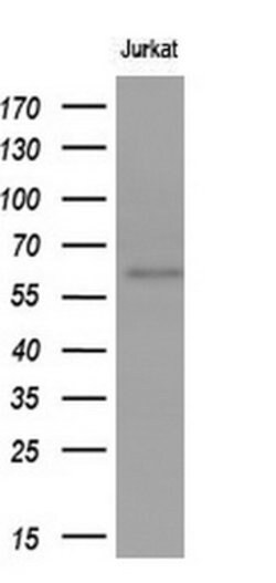 GBA Mouse anti-Human, Clone: OTI4G4, lyophilized, TrueMAB 100 &mu;g; Unconjugated:Antibodies,
