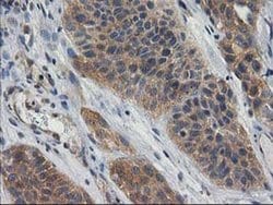 GBA3 Monoclonal Antibody (OTI1F1), TrueMAB , OriGene 30 &mu;L; Unconjugated:Antibodies,