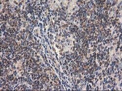 GBA3 Monoclonal Antibody (OTI1F1), TrueMAB , OriGene 30 &mu;L; Unconjugated:Antibodies,