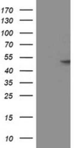 GBA3 Mouse anti-Human, Clone: OTI5G5, lyophilized, TrueMAB 100 &mu;g; Unconjugated:Antibodies,