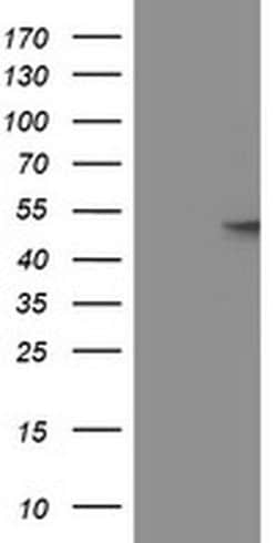 GBA3 Monoclonal Antibody (OTI5G5), TrueMAB , OriGene 100 &mu;L; Unconjugated:Antibodies,
