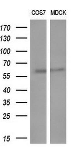 GBA3 Monoclonal Antibody (OTI5G5), TrueMAB , OriGene 100 &mu;L; Unconjugated:Antibodies,