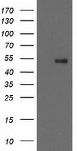 GBA3 Monoclonal Antibody (OTI4G8), TrueMAB , OriGene:Antibodies:Primary