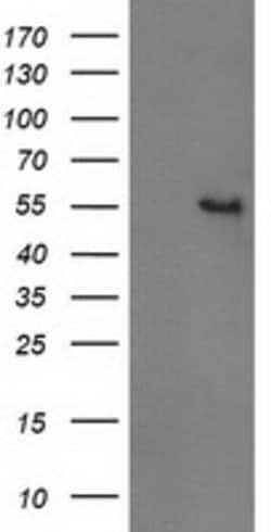 GBA3 Mouse anti-Human, Clone: OTI1F1, lyophilized, TrueMAB 100 &mu;g; Unconjugated:Antibodies,