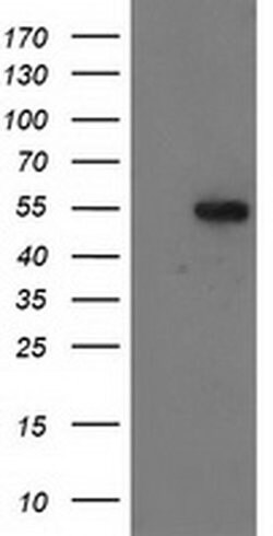 GBA3 Monoclonal Antibody (OTI4C7), TrueMAB , OriGene 100 &mu;L; Unconjugated:Antibodies,