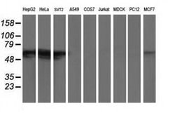 GBA3 Monoclonal Antibody (OTI4F10), TrueMAB , OriGene 100 &mu;L; Unconjugated:Antibodies,