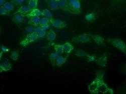 GBAS Monoclonal Antibody (OTI1D6), TrueMAB , OriGene 100 &mu;L; Unconjugated:Antibodies,
