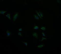 GBAS Monoclonal Antibody (OTI1B2), TrueMAB , OriGene 100 &mu;L; Unconjugated:Antibodies,