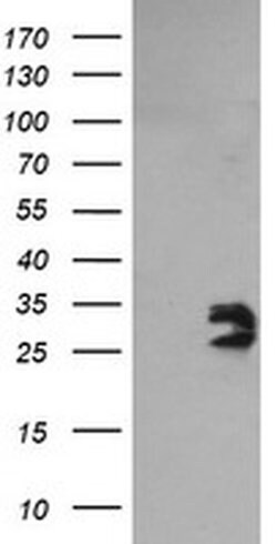 GBAS Monoclonal Antibody (OTI1D6), TrueMAB , OriGene 100 &mu;L; Unconjugated:Antibodies,