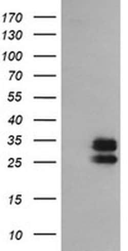 GBAS Monoclonal Antibody (OTI1B2), TrueMAB , OriGene 100 &mu;L; Unconjugated:Antibodies,