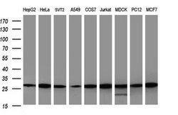 GBAS Monoclonal Antibody (OTI1B2), TrueMAB , OriGene 100 &mu;L; Unconjugated:Antibodies,