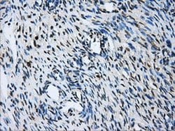 GBE1 Mouse anti-Human, Clone: OTI5B7, liquid, TrueMAB 100 &mu;L; Unconjugated:Antibodies,