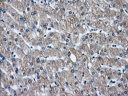 GBE1 Mouse anti-Human, Clone: OTI5B7, liquid, TrueMAB 100 &mu;L; Unconjugated:Antibodies,