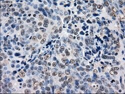 GBE1 Mouse anti-Human, Clone: OTI3C8, liquid, TrueMAB 100 &mu;L; Unconjugated:Antibodies,