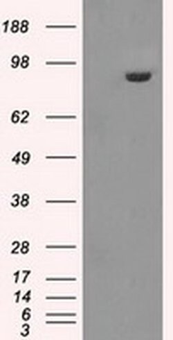 GBE1 Mouse anti-Human, Clone: OTI5B7, liquid, TrueMAB 100 &mu;L; Unconjugated:Antibodies,