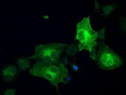 GBP2 Mouse anti-Human, Clone: OTI1G1, lyophilized, TrueMAB 100 &mu;g; Unconjugated:Antibodies,
