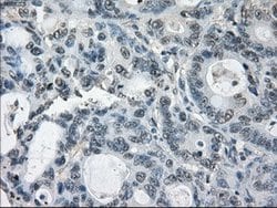 GBP2 Mouse anti-Human, Clone: OTI1G1, lyophilized, TrueMAB 100 &mu;g; Unconjugated:Antibodies,