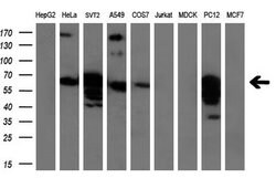 GBP2 Mouse anti-Human, Clone: OTI4H2, lyophilized, TrueMAB 100 &mu;g; Unconjugated:Antibodies,