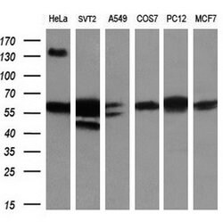 GBP2 Mouse anti-Human, Clone: OTI5E10, lyophilized, TrueMAB 100 &mu;g;