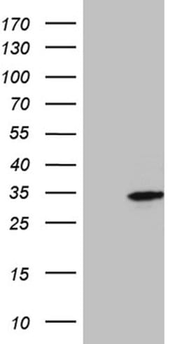 GCH1 Mouse anti-Human, Clone: OTI2D12, lyophilized, TrueMAB 100 &mu;g;