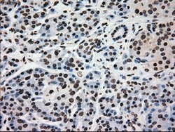 GCK Mouse anti-Human, Clone: OTI3E3, lyophilized, TrueMAB 100 &mu;g; Unconjugated:Antibodies,