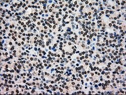 GCK Mouse anti-Human, Clone: OTI3E3, lyophilized, TrueMAB 100 &mu;g; Unconjugated:Antibodies,