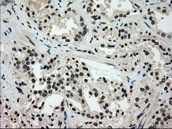 GCK Mouse anti-Human, Clone: OTI3E3, lyophilized, TrueMAB 100 &mu;g; Unconjugated:Antibodies,