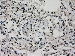 GCK Mouse anti-Human, Clone: OTI3E3, lyophilized, TrueMAB 100 &mu;g; Unconjugated:Antibodies,