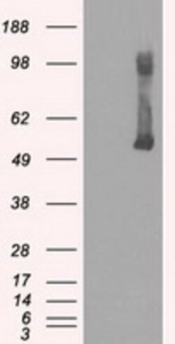 GCK Mouse anti-Human, Clone: OTI3E3, lyophilized, TrueMAB 100 &mu;g; Unconjugated:Antibodies,