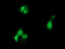 GCKR Monoclonal Antibody (OTI1E7), TrueMAB , OriGene 100 &mu;L; Unconjugated:Antibodies,