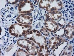 GCKR Monoclonal Antibody (OTI1E7), TrueMAB , OriGene 100 &mu;L; Unconjugated:Antibodies,