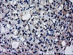 GCKR Mouse anti-Human, Clone: OTI1E7, lyophilized, TrueMAB 100 &mu;g; Unconjugated:Antibodies,