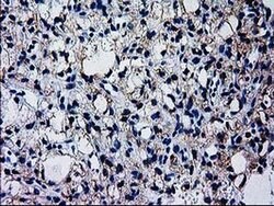 GCKR Monoclonal Antibody (OTI1E7), TrueMAB , OriGene 100 &mu;L; Unconjugated:Antibodies,