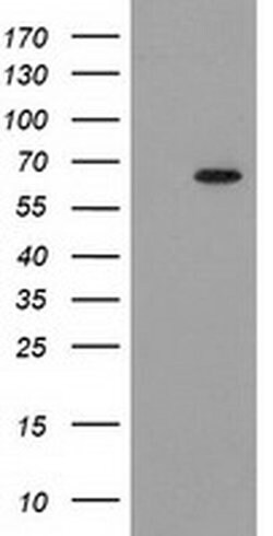 GCKR Monoclonal Antibody (OTI1E7), TrueMAB , OriGene 100 &mu;L; Unconjugated:Antibodies,