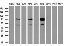 GCKR Monoclonal Antibody (OTI1E7), TrueMAB , OriGene 100 &mu;L; Unconjugated:Antibodies,
