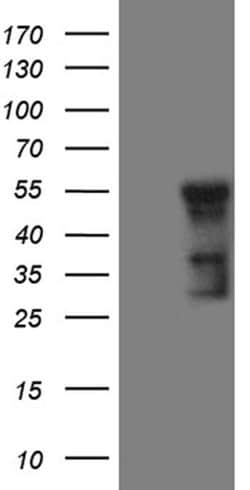 GCM1 Monoclonal Antibody (OTI1A5), TrueMAB , OriGene 100 &mu;L; Unconjugated:Antibodies,