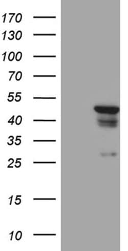 GCM1 Monoclonal Antibody (OTI5F9), TrueMAB , OriGene 100 &mu;L; Unconjugated:Antibodies,