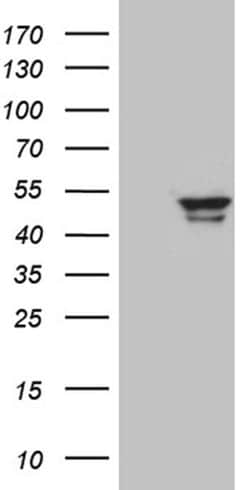GCM1 Monoclonal Antibody (OTI1A4), TrueMAB , OriGene 100 &mu;L; Unconjugated:Antibodies,