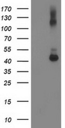GDAP1L1 Monoclonal Antibody (OTI1C3), TrueMAB , OriGene 30 &mu;L | Buy Online | Origene Technologies | Fisher Scientific