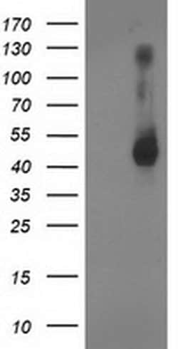 GDAP1L1 Monoclonal Antibody (OTI1A5), TrueMAB , OriGene 30 &mu;L; Unconjugated:Antibodies,