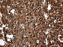 GDI1 Monoclonal Antibody (OTI1B1), TrueMAB , OriGene 100 &mu;L; Unconjugated:Antibodies,